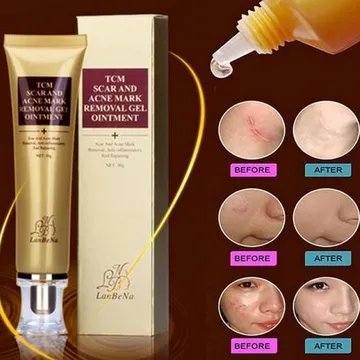 TCM Scar and Acne Mark Removal Gel Ointment Cream Removing Anti-inflammatory and Repairing - Pei mei