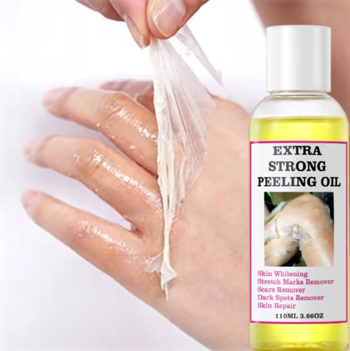 Dr Meinaier Peeling Oil for Dark Skin, Strong Peeling Oil Extra Strength, Exfoliating Peeling Solution for Body All Skin Type Dead Skin Remover (110ML/3.88 OZ)