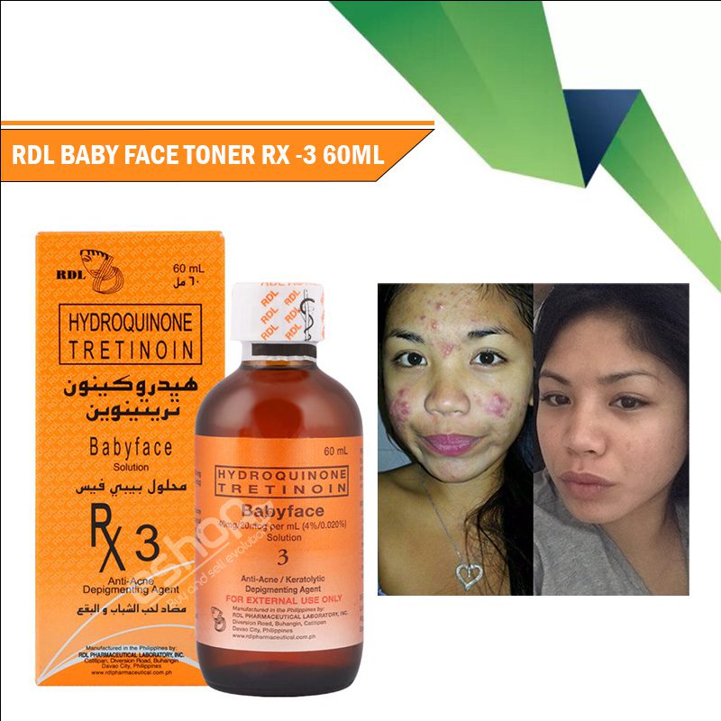 Tretinoin RX3 Babyface Soln. Hydroquinone Spots Blemish Discoloration