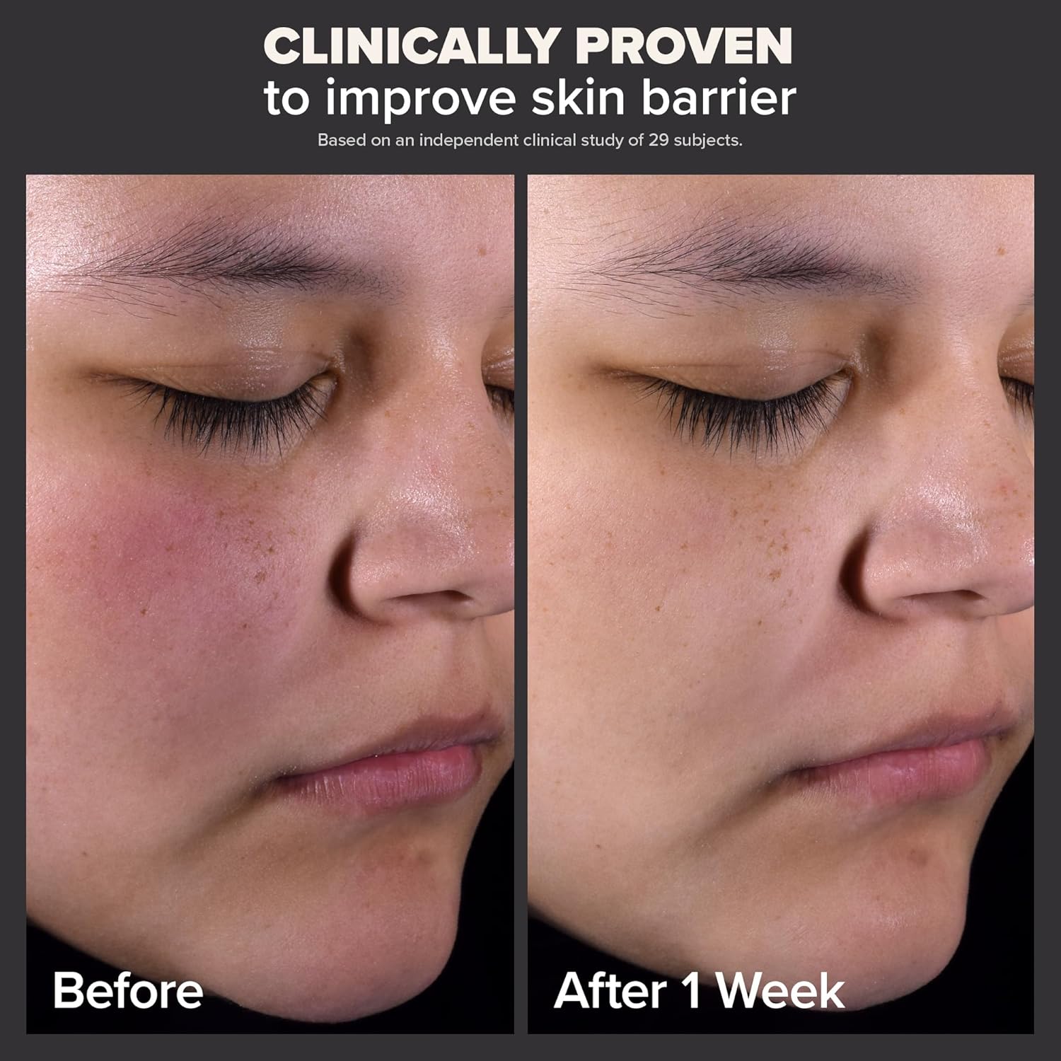 PAULA'S CHOICE SALICYLIC ACID Skin Perfecting 2% BHA Liquid Exfoliant - Rapid Hydrating Super Glowing Skin Tone