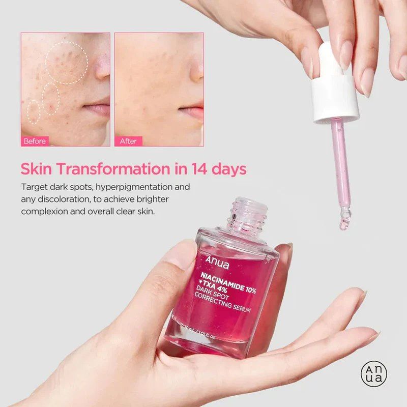 Anua 70% Daily Lotion + Anua Niacinamide 10% + TXA 4% Dark Spot Correcting Serum. Hydrates, Removes Dark Spots, Hyperpigmentations, Post Acne Scars, Evens the skin tone, Soothes Irritation & Glows