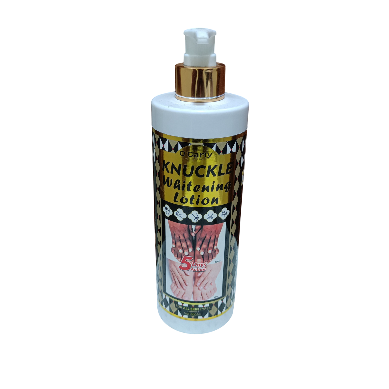Ocarly Knuckle whitening Lotion. Lightens and fade away dark spots, Remove dark knuckles, Dark Knee, Dark Elboiw, Dark Toe, Black Spots, Blemishes, evens the skin tone & Hydrates