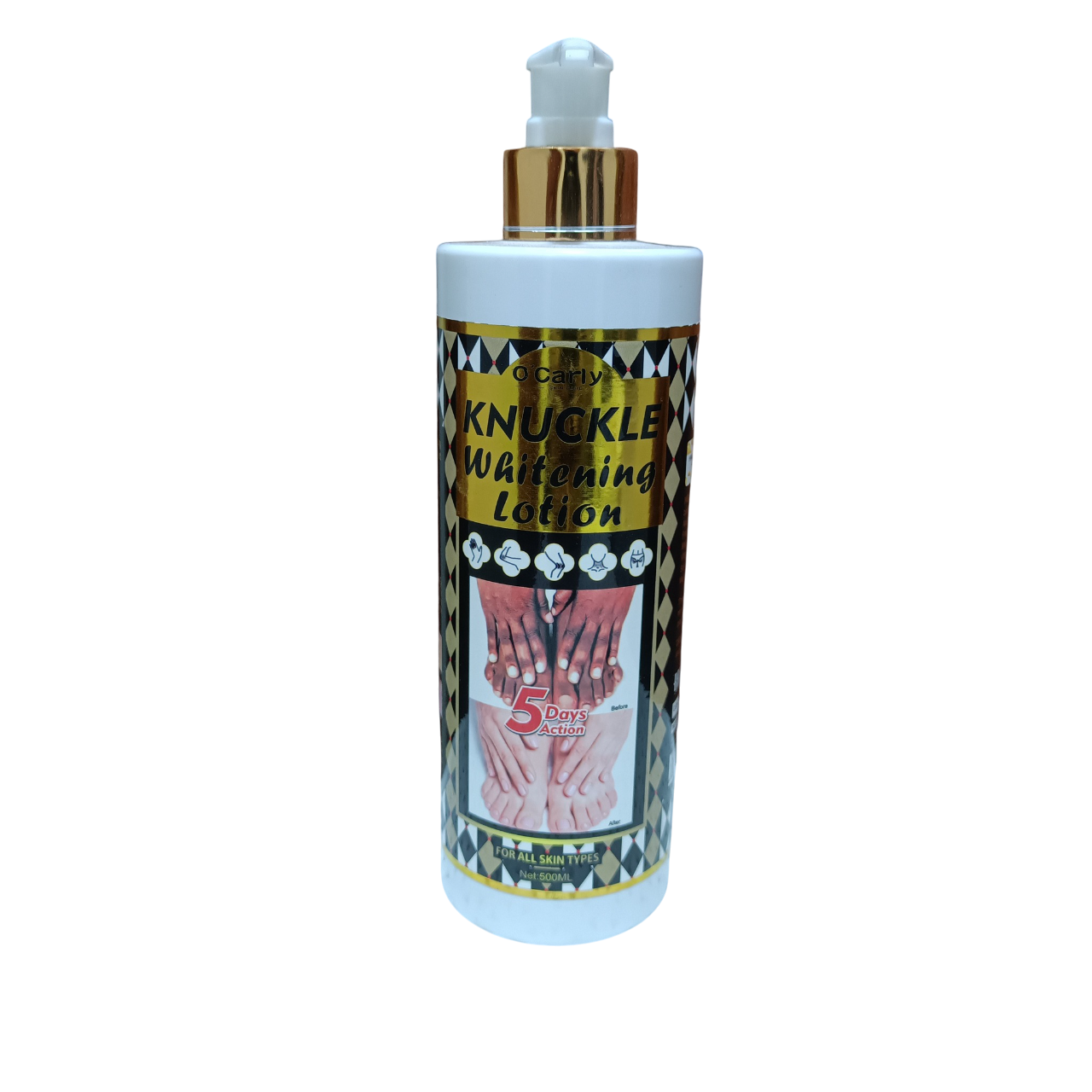 Ocarly Knuckle whitening Lotion. Lightens and fade away dark spots, Remove dark knuckles, Dark Knee, Dark Elboiw, Dark Toe, Black Spots, Blemishes, evens the skin tone & Hydrates