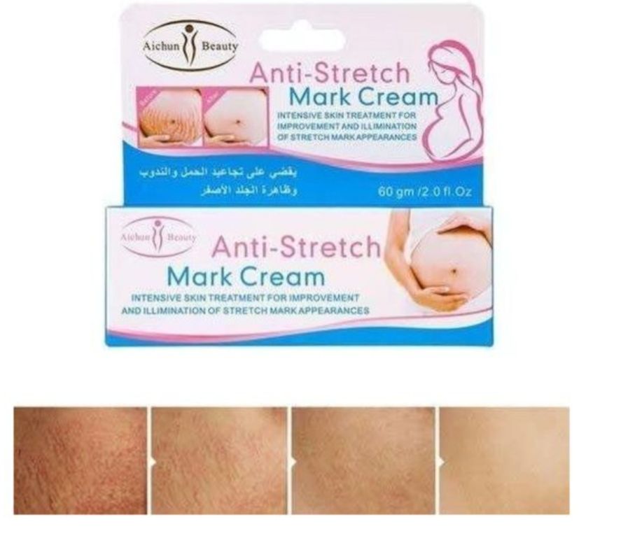 Aichun Beauty Anti-stretch Mark Cream Improve & Clears Pregnancy StretchMarks-60g
