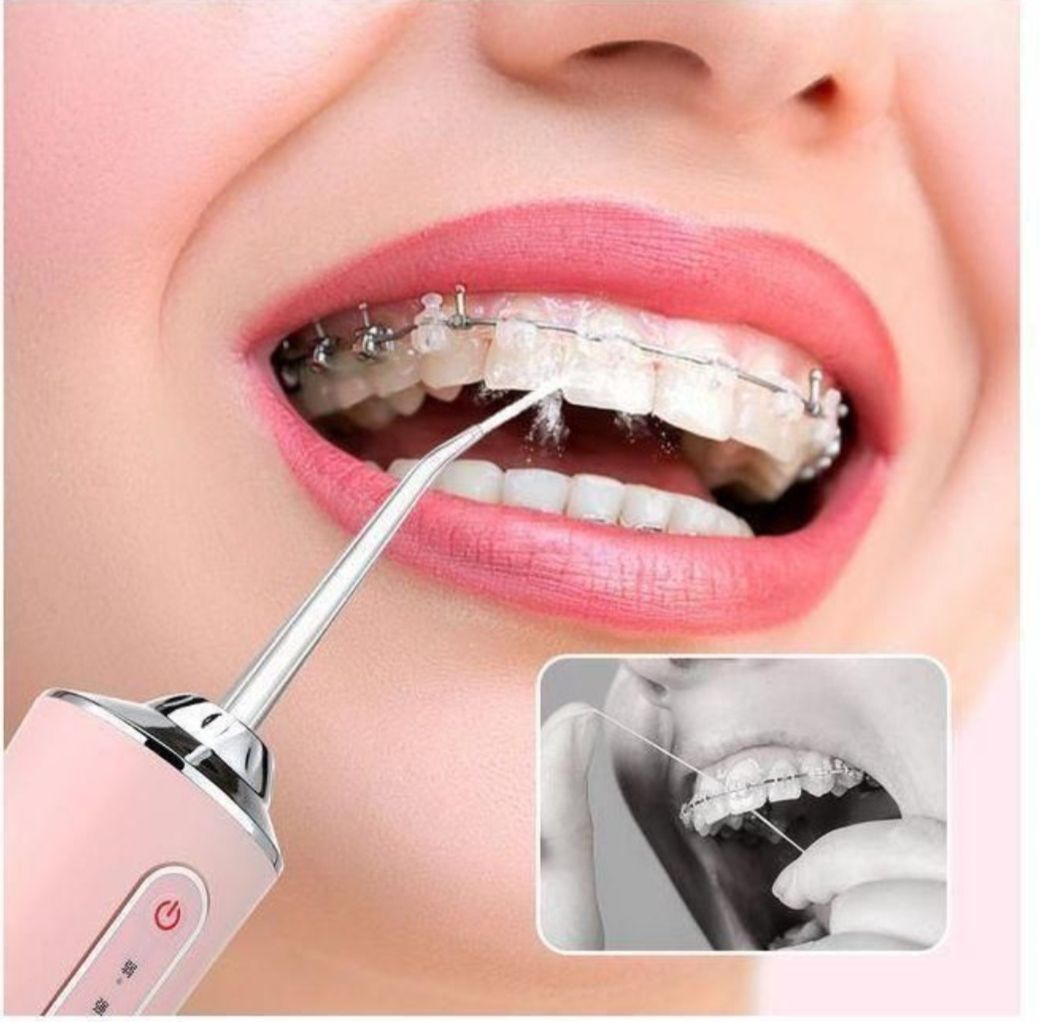 USB Rechargeable Portable Water Dental Flosser Teeth Irrigator Dental Teeth Cleaner with 4 Cleaning Nozzles Water Flosser For Teeth, Gums, Braces