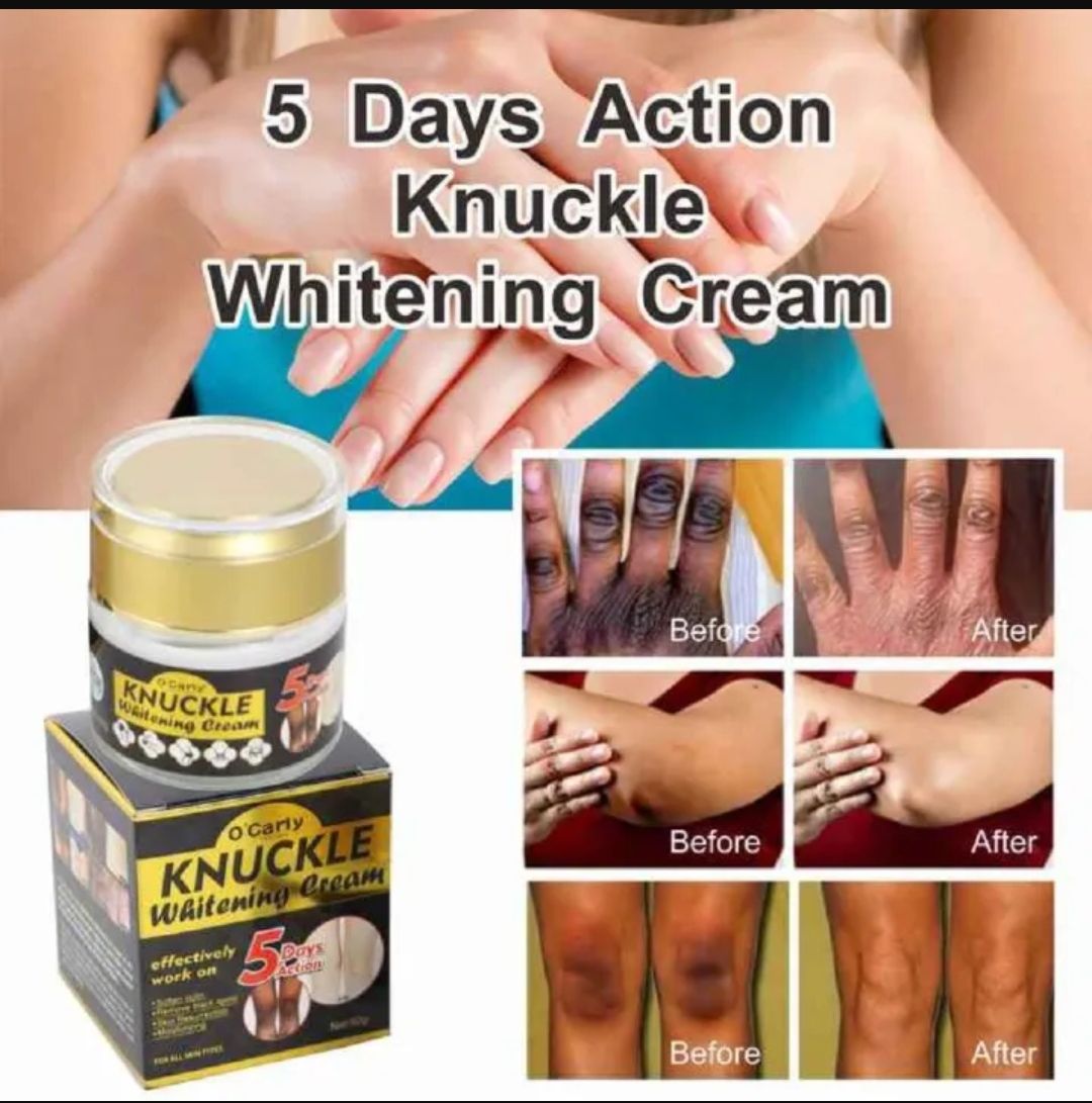 O'Carly Dark Knuckle Whitening Cream  Clears Knuckles, Elbow, joints, Knees neck,Dark Spot ,Moisturizing