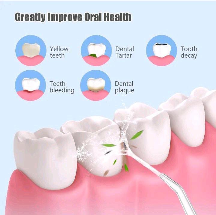 Limited Offer!!! 4 nozzles New Dental Water Jet Irrigator High Frequency Pulse Water Flosser Electric Spray Cleaning Oral 3 Modes Cordless USB Rechargable Teeth Cleaner, 220ML Water Tank/ Braces Ideal