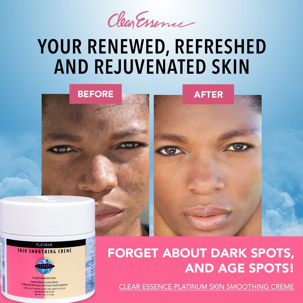 Clear Essence Medicated Fade Crème For Smooth Even Toned Complexion velvety cream absorbs quickly into the skin and contains the gold-standard for skin lightening,which visibly reduces the dark spots.
