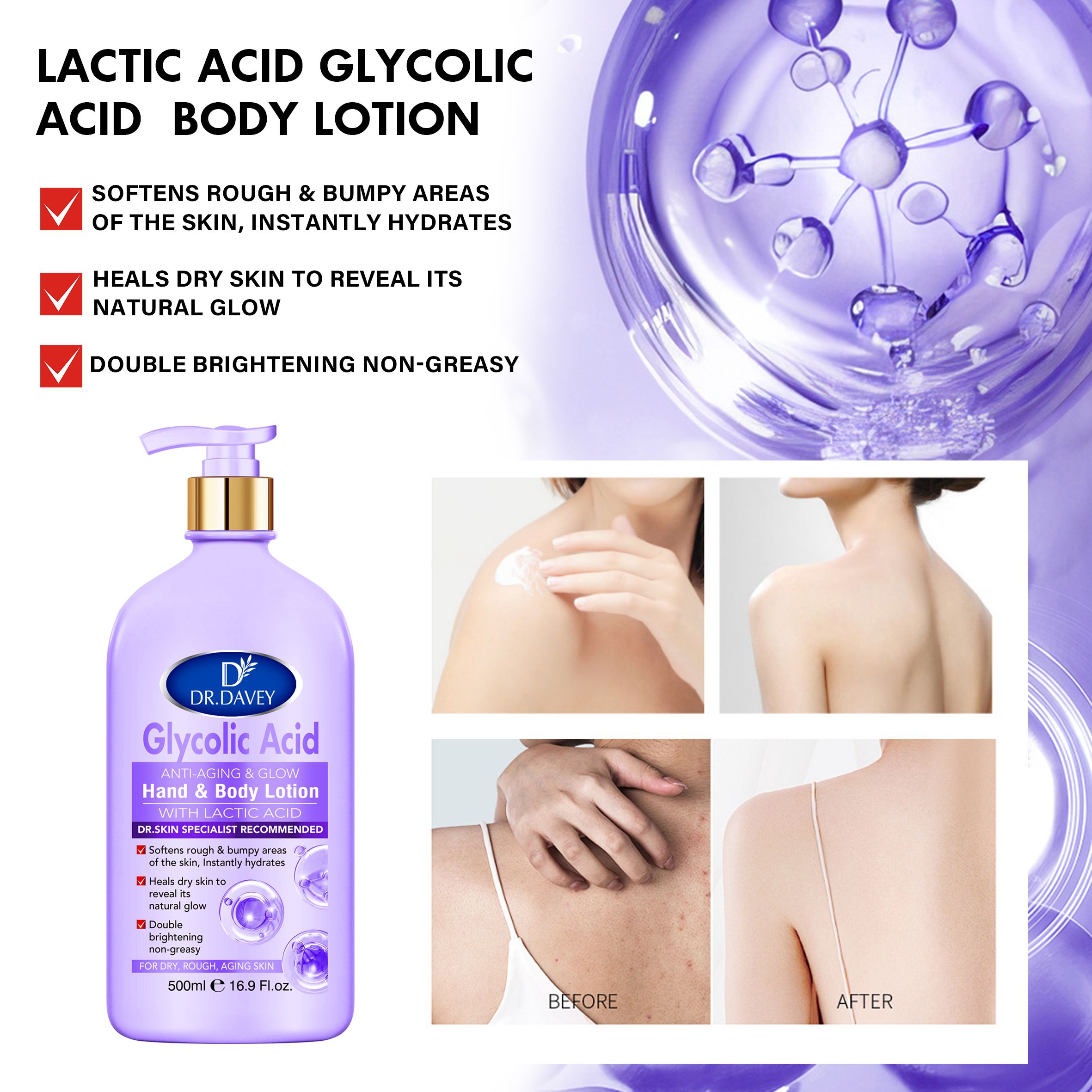 dr davey Glycolic acid anti-aging & glow hand and body lotion with lactic acid softens rough and bumpy areas of the skin instantly hydrates, heals dry skin , double brightens non greasy for dry, rough