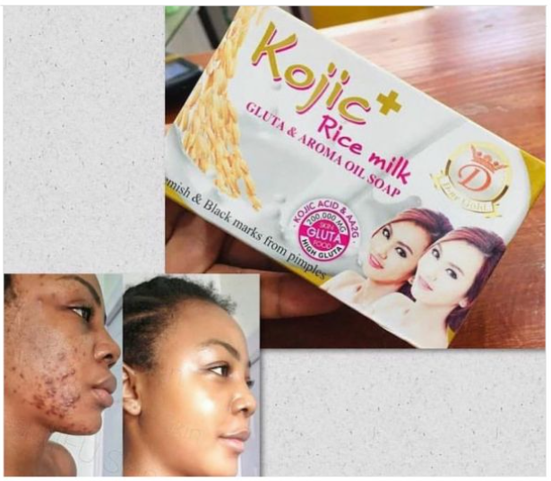 Kojic Rice Milk Gluta & Aroma Oil Soap with Niacinamide – Brightening & Dark Spot Correcting Beauty Bar