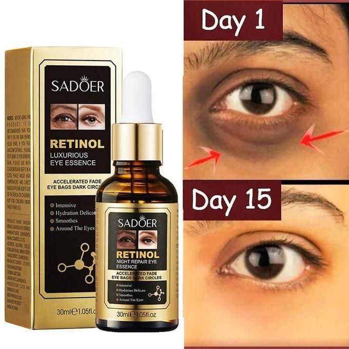 SADOER Retinol Eye Serum - Eye Cream For Dark Circles And Puffy Eyes - Anti Aging Eye Bag Removal Fade Fine Line Wrinkle - Reduce Crow Feet Hydrate Moisturize Essence For Sagging Skin - Suitable For A