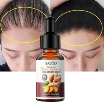 Sadoer Hair Care Serum, Ginger Hair Growth Based Product, Effective in Hair Growth,Moisturizing and Softening Forked Hair, with ScalpCare ingridients