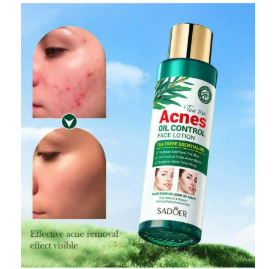 Sadoer Tea Tree Lotion - Oil Control & Acne Solution for Clear, Balanced Skin!