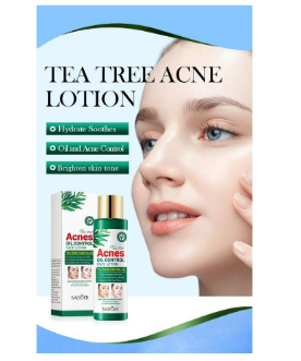 Sadoer Tea Tree Lotion - Oil Control & Acne Solution for Clear, Balanced Skin!