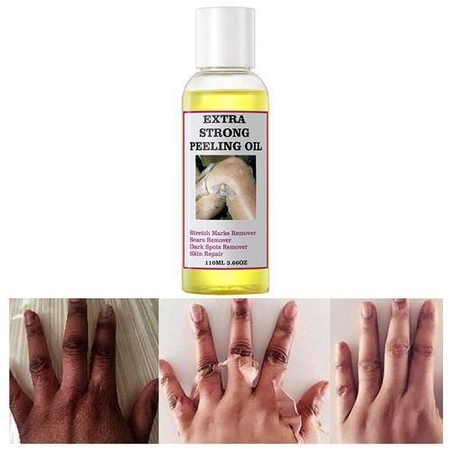 Extra Strong Peeling Oil, Peeling Oil for Dark Skin, Yellow Peeling Oil, Exfoliating Peeling Solution for Hand Feet, Chemical Peel for Face, 110ML