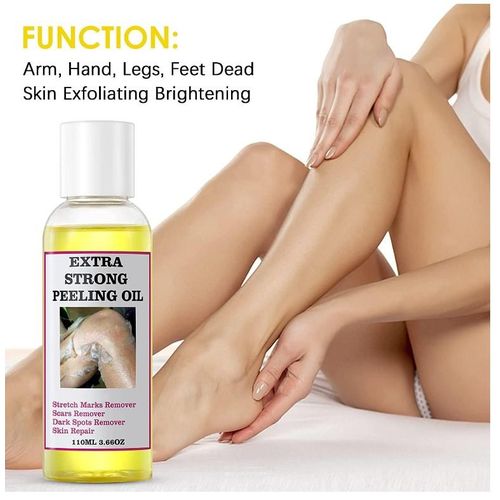 Extra Strong Peeling Oil, Peeling Oil for Dark Skin, Yellow Peeling Oil, Exfoliating Peeling Solution for Hand Feet, Chemical Peel for Face, 110ML