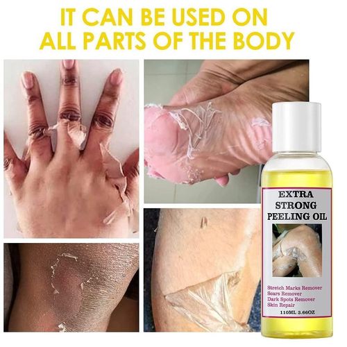 Extra Strong Peeling Oil, Peeling Oil for Dark Skin, Yellow Peeling Oil, Exfoliating Peeling Solution for Hand Feet, Chemical Peel for Face, 110ML