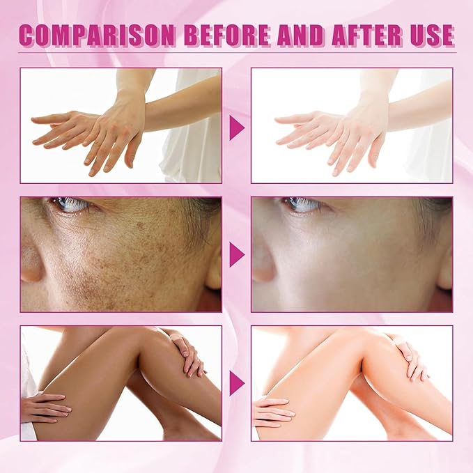 Extra Strong Peeling Oil, Peeling Oil for Dark Skin, Yellow Peeling Oil, Exfoliating Peeling Solution for Hand Feet, Chemical Peel for Face, 110ML