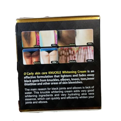 O'Carly Knuckle Whitening Cream. Clears Dark Knuckles, Elbow, Spots.