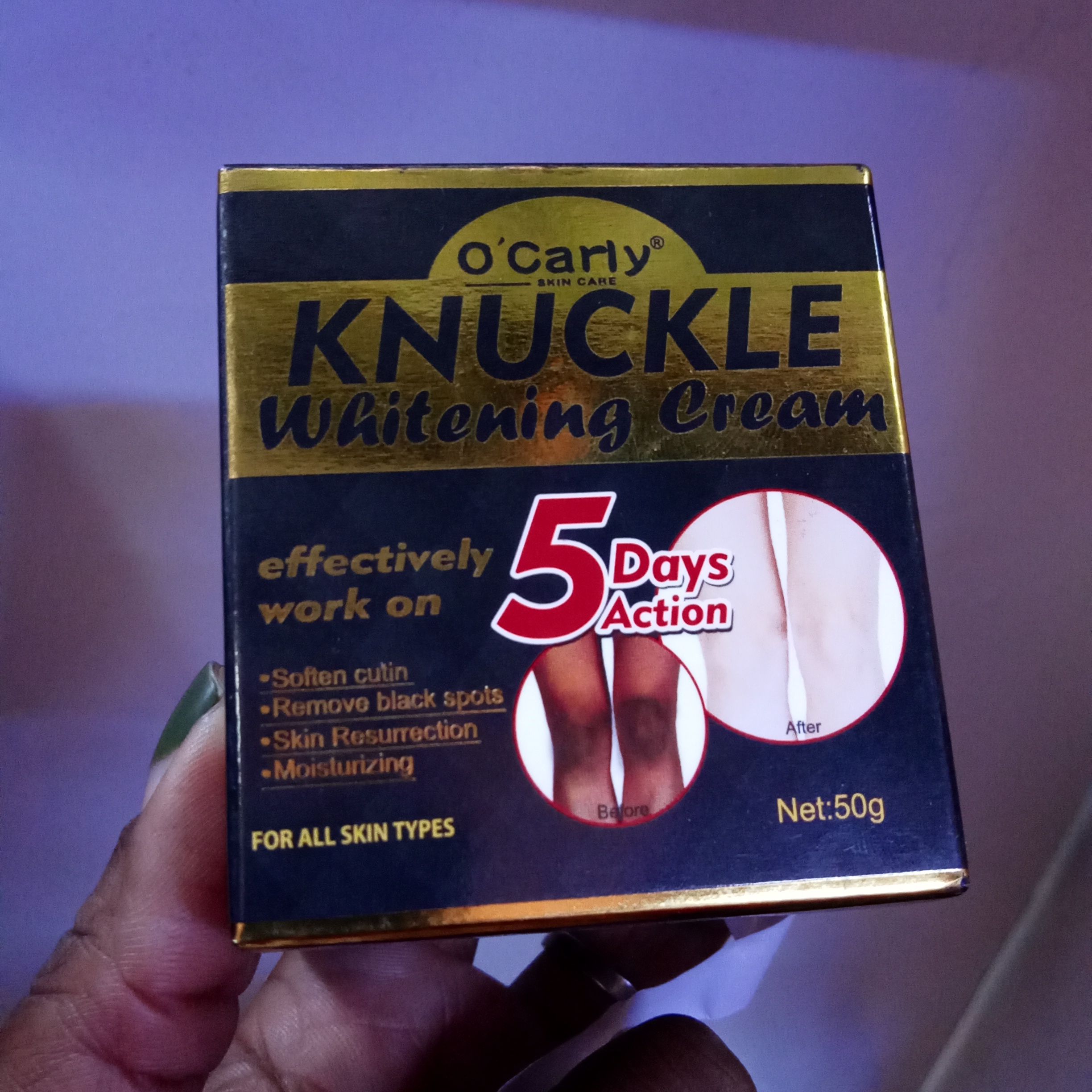 O'Carly Knuckle Whitening Cream. Clears Dark Knuckles, Elbow, Spots.