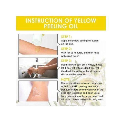 Extra Strong Peeling Oil, Peeling Oil for Dark Skin, Yellow Peeling Oil, Exfoliating Peeling Solution for Hand Feet, Chemical Peel for Face, 110ML