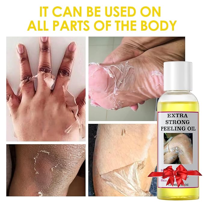 Extra Strong Peeling Oil, Peeling Oil for Dark Skin, Yellow Peeling Oil, Exfoliating Peeling Solution for Hand Feet, Chemical Peel for Face, 110ML