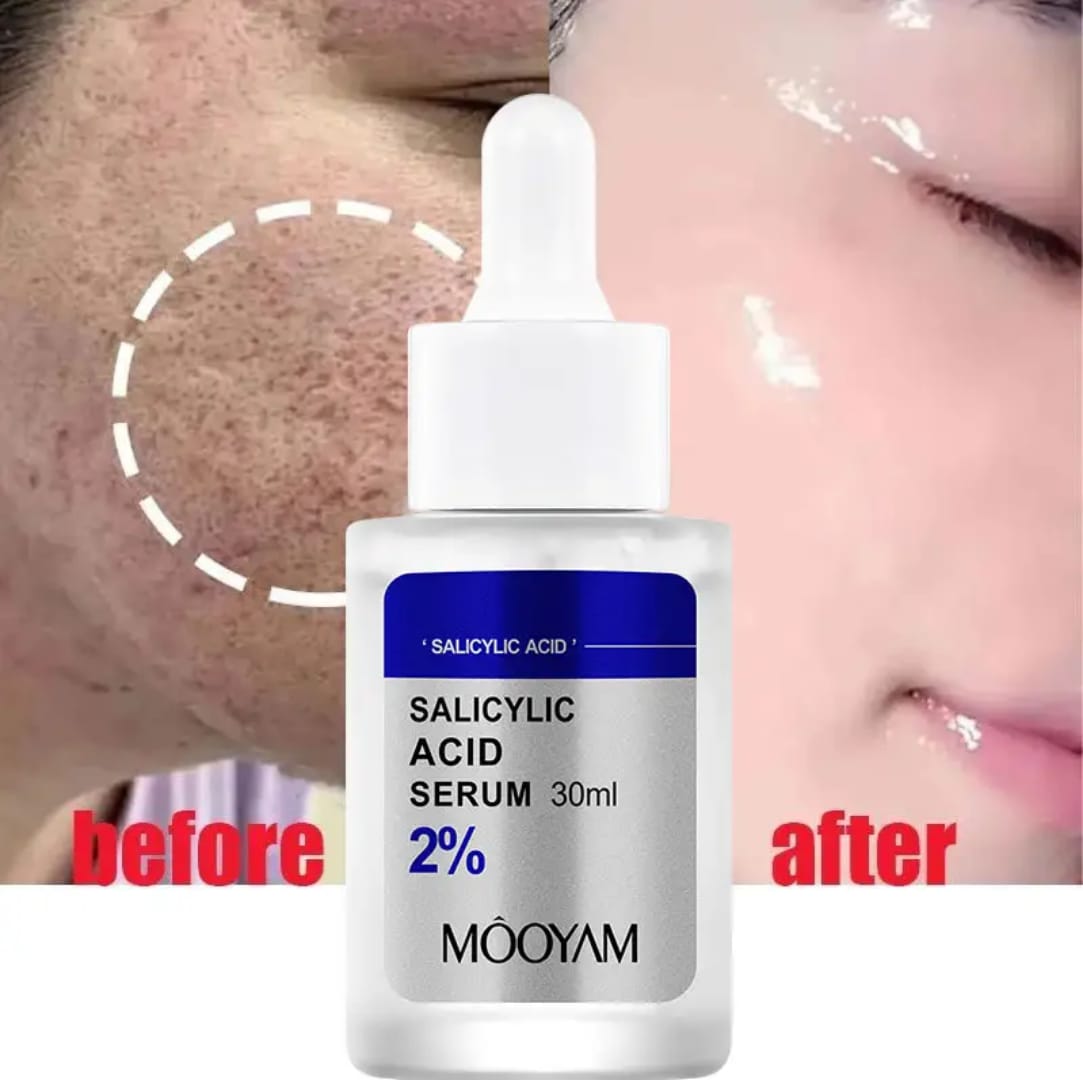 SALICYCLIC ACID PORE SHRINKING SERUM QUICK REMOVE BLACKHEADS SMOOTH SKIN TIGHTEN FACE ELIMINATES LARGE PORES KOREAN PRODUCT