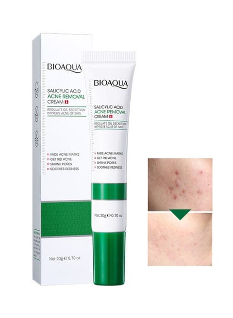 BIOAQUA Bioaoua Salicylic Acid Acne Removal Cream Fades Acne Marks, Eliminates Pimples, Remove Acne, Soothes Redness, Shrink Pores 20g