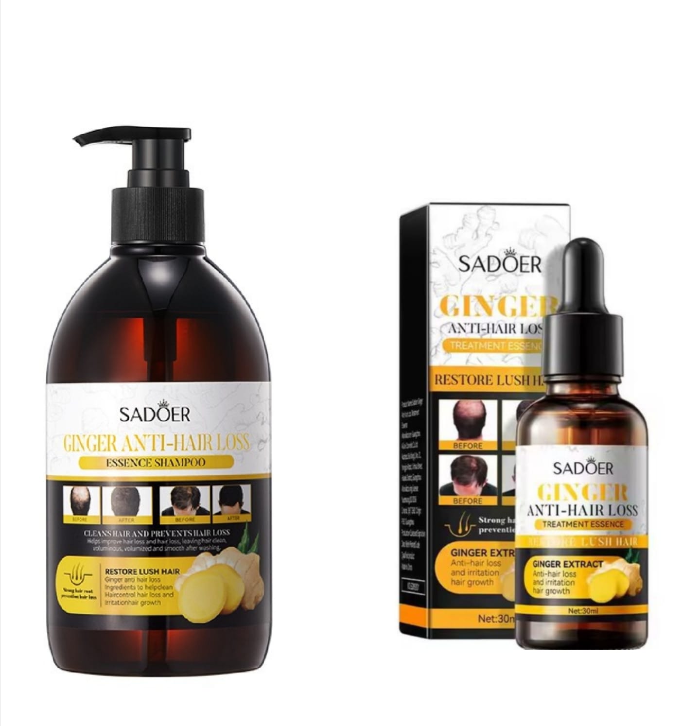 SADOER 2 in 1 Hair Shampoo+Anti Hair Loss Essense SERUM Treatment Shampoo Essence, Hair Growth Ginger Extract Beard Growth,Hair Growth, Anti Dandruffs Hair Moisturizing Hair Care Shampoo, Derma Roller