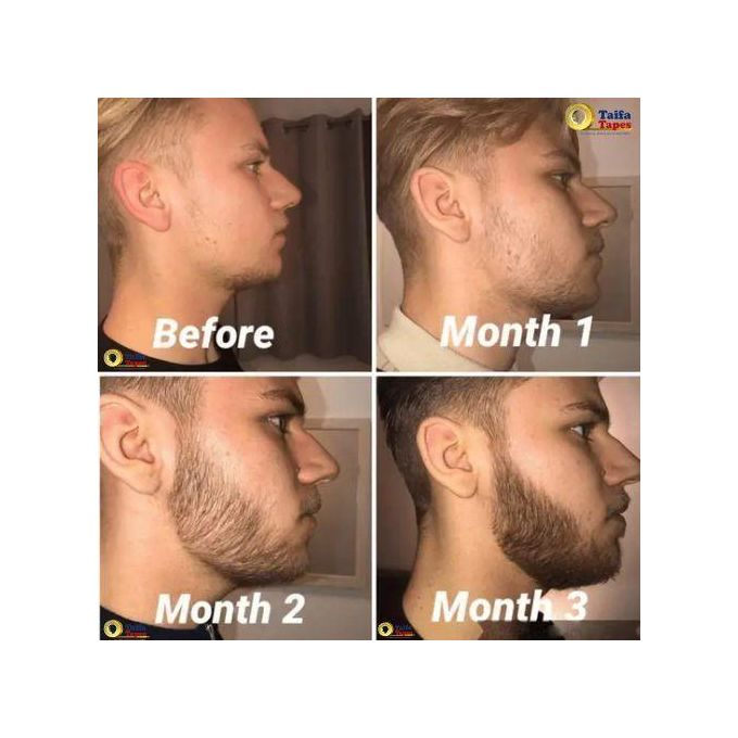 DERMA ROLLER Acne removal, Beard & Hair Growth, Anti Aging ,Removes Stretchmarks Boosts Minoxidil Absorption 540 Microneedling , Clearer Skin & Collagen Boost Anti-acne, Anti-aging, Antiwrinkle