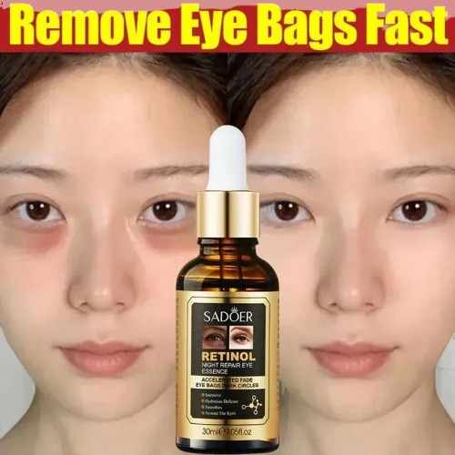 SADOER Luxury Eyes Essence Serum Eye Care Moisturizer Anti Wrinkle Skin Care Serum Anti Aging Retinol Repair Eye Serum Retinol Eye Serum Dark CirclesRetinol Serum Firming Brightening AntiAging eye bag