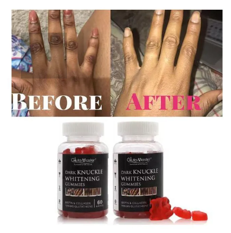 GlutaMaster Dark Knuckles Whitening Gummies with Biotin, Collagen and Glutathione lightening brightening gummies