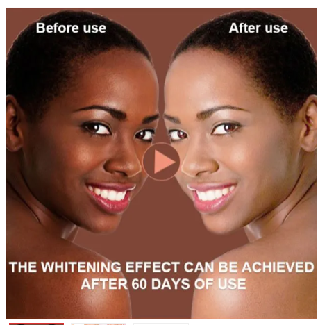 GlutaMaster SKIN WHITENING GUMMIES With Glutathione, Collagen & Biotin For Hydrated Youthful Skin Glow and Spots Fading Anti-aging Gummies.New