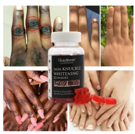 GlutaMaster Dark Knuckles Whitening Gummies with Biotin, Collagen and Glutathione lightening brightening gummies