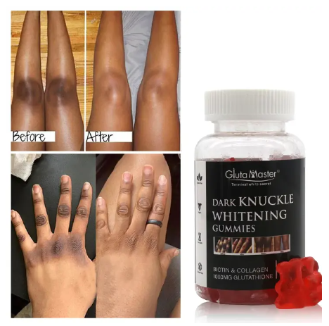 GlutaMaster Dark Knuckles Whitening Gummies with Biotin, Collagen and Glutathione lightening brightening gummies