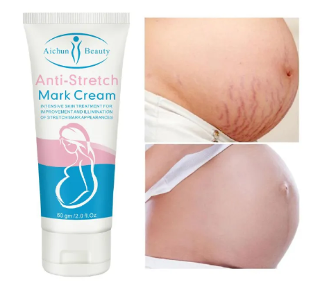 Removes Stretch Mark Cream To Remove Postpartum Obesity Pregnant Women Repair Anti-Aging Anti-Wrinkles Firming Body Cream Intensive Skin Treatment