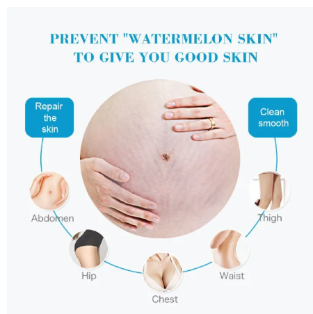 Removes Stretch Mark Cream To Remove Postpartum Obesity Pregnant Women Repair Anti-Aging Anti-Wrinkles Firming Body Cream Intensive Skin Treatment