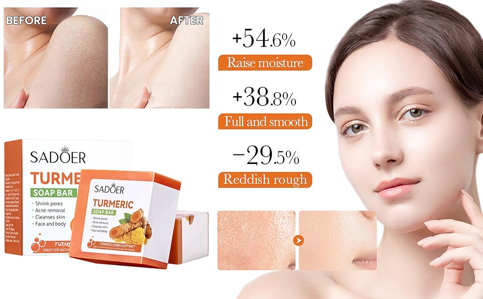Sadoer Turmeric Soap Bar, Hydrating Turmeric Soap Bar Skin Care for Shower, Smoothing and Cleanses Skin Face Wash Soap Face Serum, Face Wash Oily Skin Bar Soap for Face and Body (2PcsSoap)