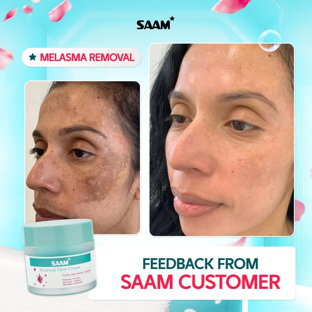 Renewal Face Cream | Melasma, Freckles, Age Spots & Dark Spots | With Alpha Arbutin and Kojic Acid | 50g