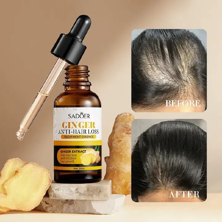 SADOER Ginger Plant Hair Growth Serum Nutrition Hair Care Hair Essence 30ml