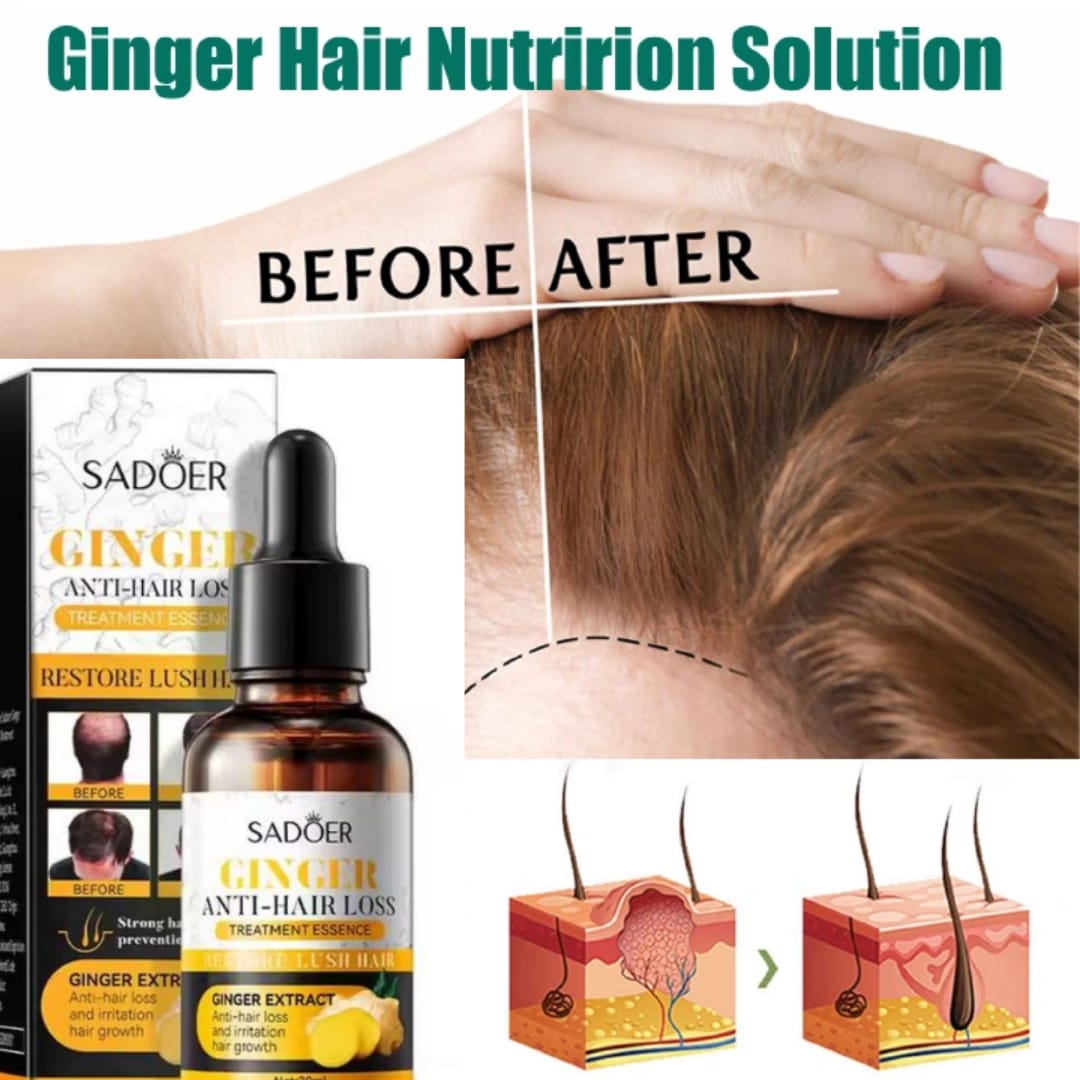 SADOER Ginger Plant Hair Growth Serum Nutrition Hair Care Hair Essence 30ml