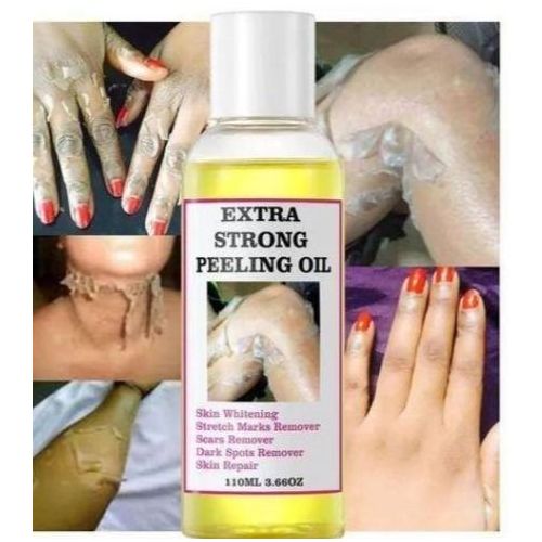 MOOYAM Extra Strong Peeling Oil For Dead Skin ,Stretch Marks, Dark Spot Remover, Skin Repair