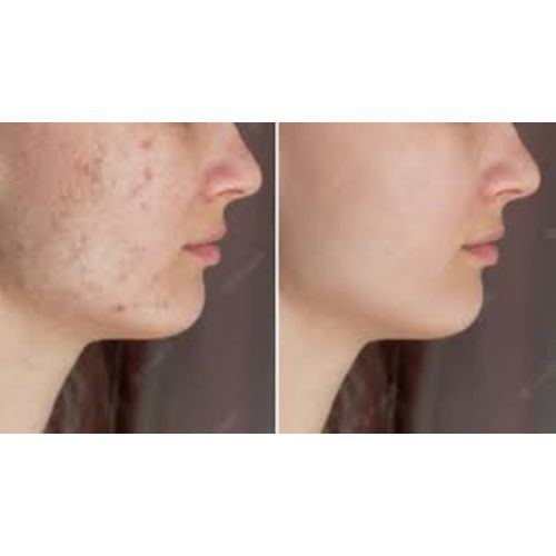 Asantee Tamarind And Goat Milk Herbal Soap