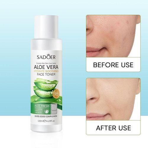Best price for Sadoer 2PCS Aloe Vera Face Toner & Face Cream CreamIt ...