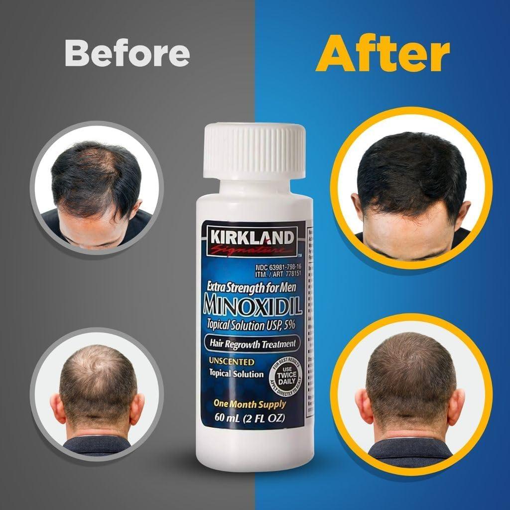 Authentic Signature Hair Regrowth Treatment Extra Strength for Men, 5% Minoxidil Topical Solution