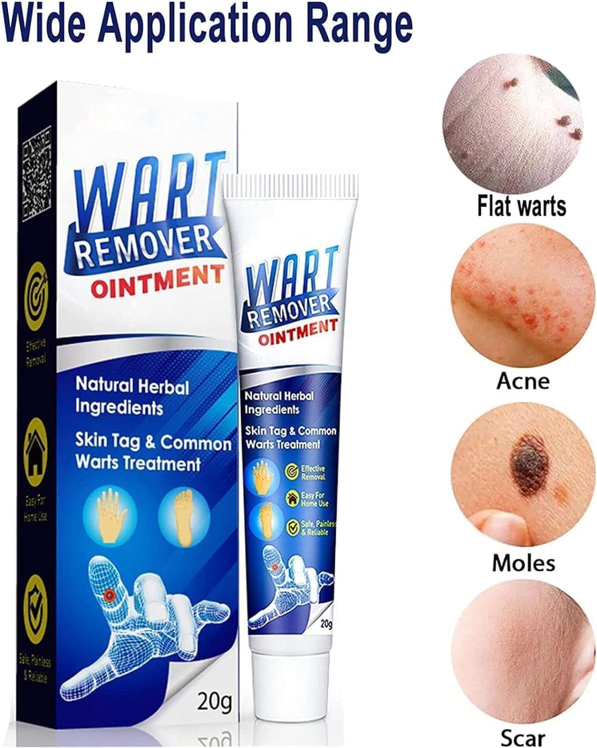 Wart Remover Cream Fast Acting Advanced Wart Removal Formula Skin Wart Removal Treatment