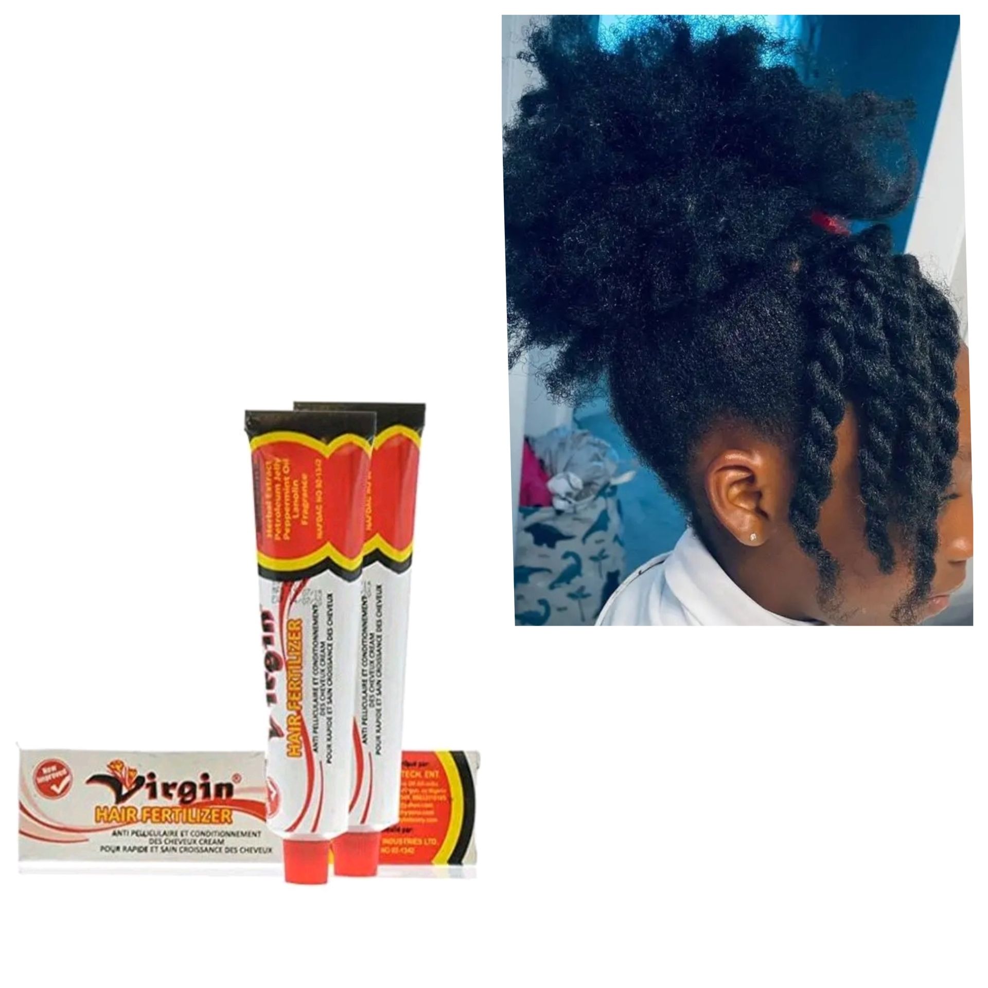 Virgin Hair Fertilizer- New Improved Anti Dandruff &Hair Conditioning for Rapid &Healthy Mega Hair Growth, Repair damaged Hair, Instant Scalp soothing, Rejuvenates long &thick hair, Moisturiser