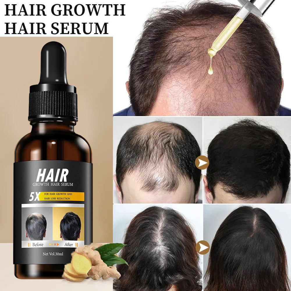 Best Price For 30ml Rapid Hair Growth Serum For Black Women And Men 