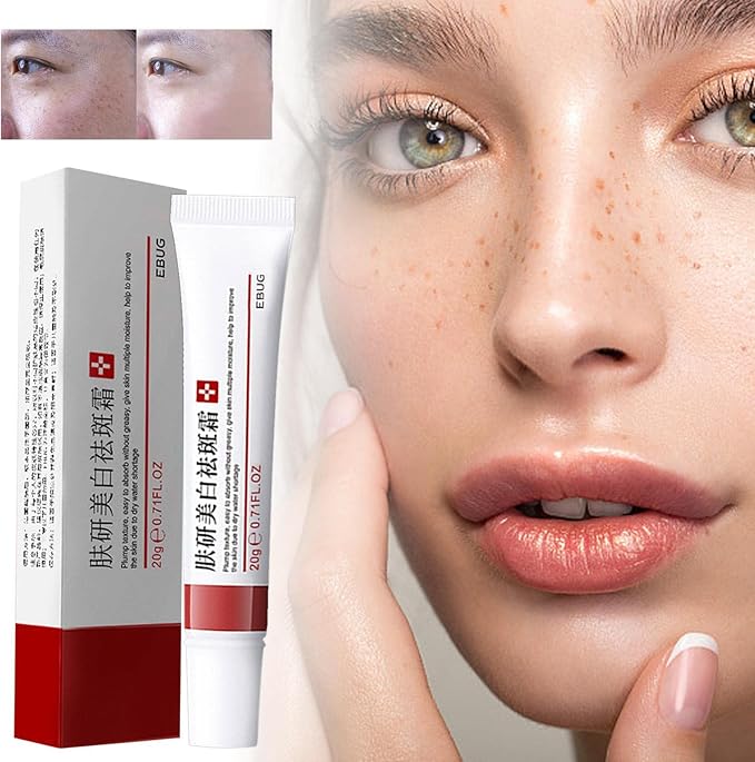 EBUG Dark spot corrector cream whitening anti-freckle Melasma treatment Pigmentation and Acne Scar Removal