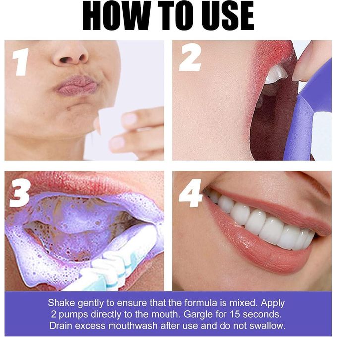 Lanthome V34 teeth whitening and stain remover mousse Colour Corrector restores brightness and neutralises yellow tones on the tooth surface
